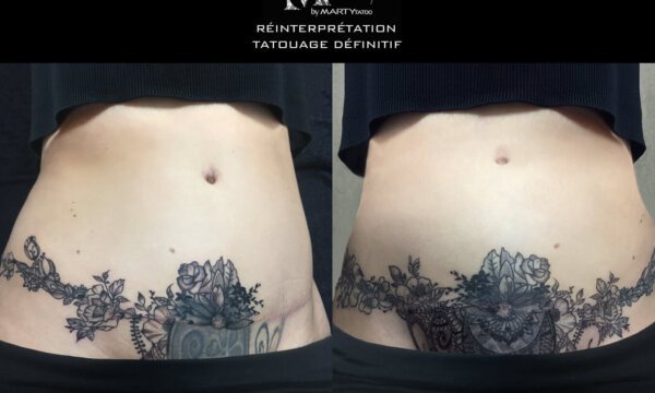 réinterprétation,tatouage définitif, tatouage médical, tatouage art thérapie, cover tatoo, tatouage cover , ancien tatouage, permanent tatoo